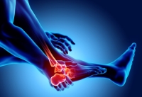 Simple Exercise for Rheumatoid Arthritis Foot Pain