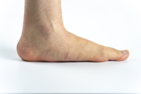Do I Need to See a Podiatrist for Flat Feet?