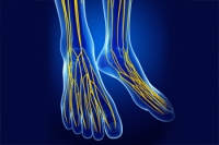 Nerve Compression in the Ankle May Cause Pain, Burning, and Numbness